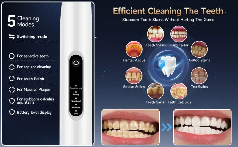 Pet ultra sônico limpador de dentes filhote de cachorro escova de dentes cão aliciamento escova de dentes elétrica para limpeza oral animais de estimação cães acessórios